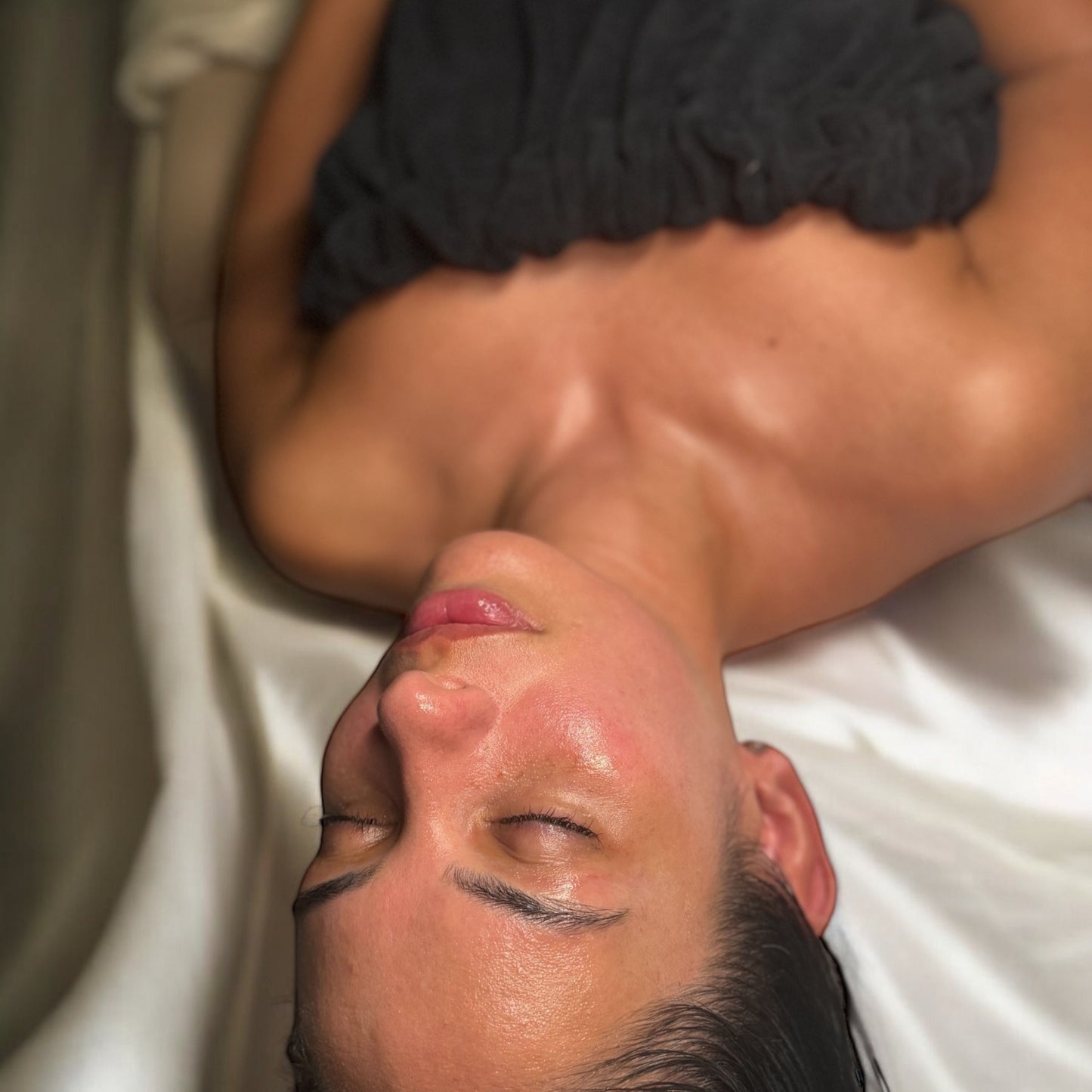 Advanced Chemical Peel Course image 0
