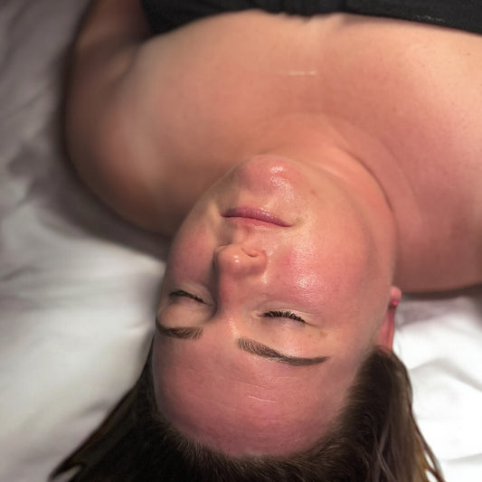 Microneedling Course (Collagen Indiction Therapy) image 0