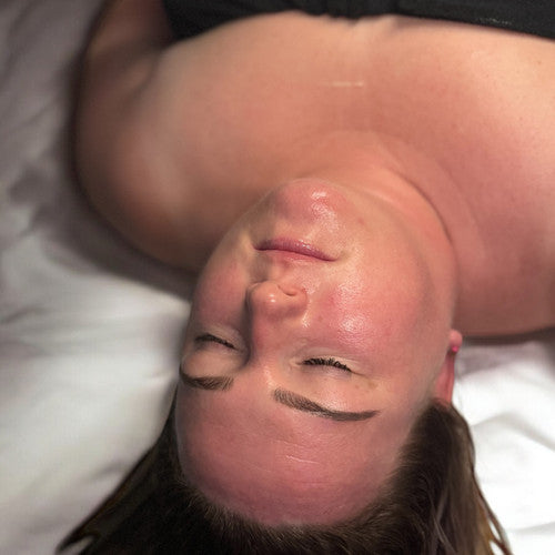 Microneedling Course (Collagen Indiction Therapy)